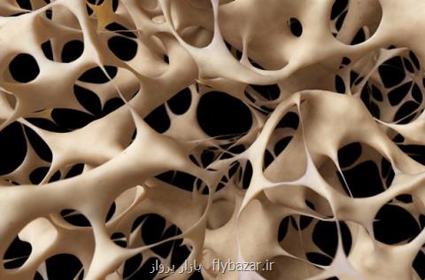 ساخت داربست های استخوانی با چاپگرهای سه بعدی توسط محققان كشور