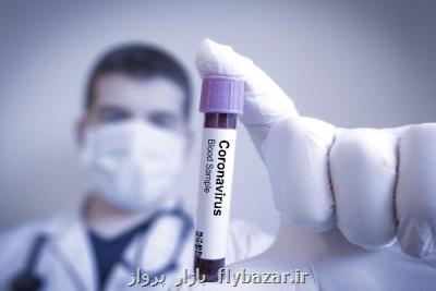 محققان روس به آنتی بادی ویروس كرونا دست پیدا كردند